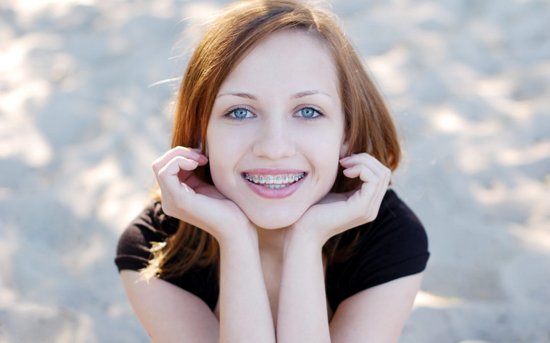 What Will I Look Like With Braces? Calming Kids’ Orthodontic Fears