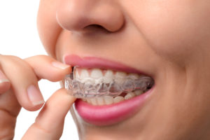 pros and cons of invisalign