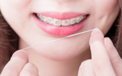 A Step by Step Helpful Guide to Flossing With Braces