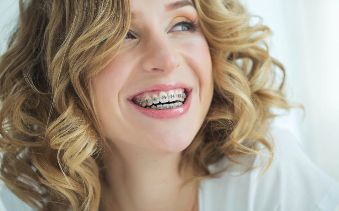 How To Find The Right Adult Orthodontic Options To Fit Your Needs 1240