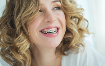How To Find The Right Adult Orthodontic Options To Fit Your Needs