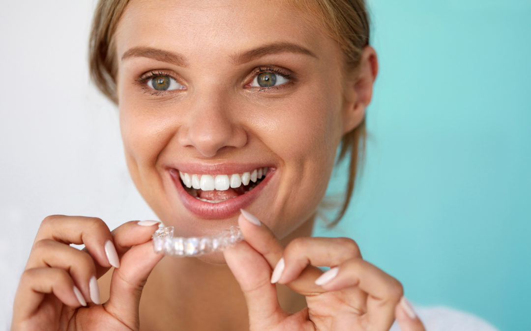 How Long Does Invisalign Take to Straighten Teeth?