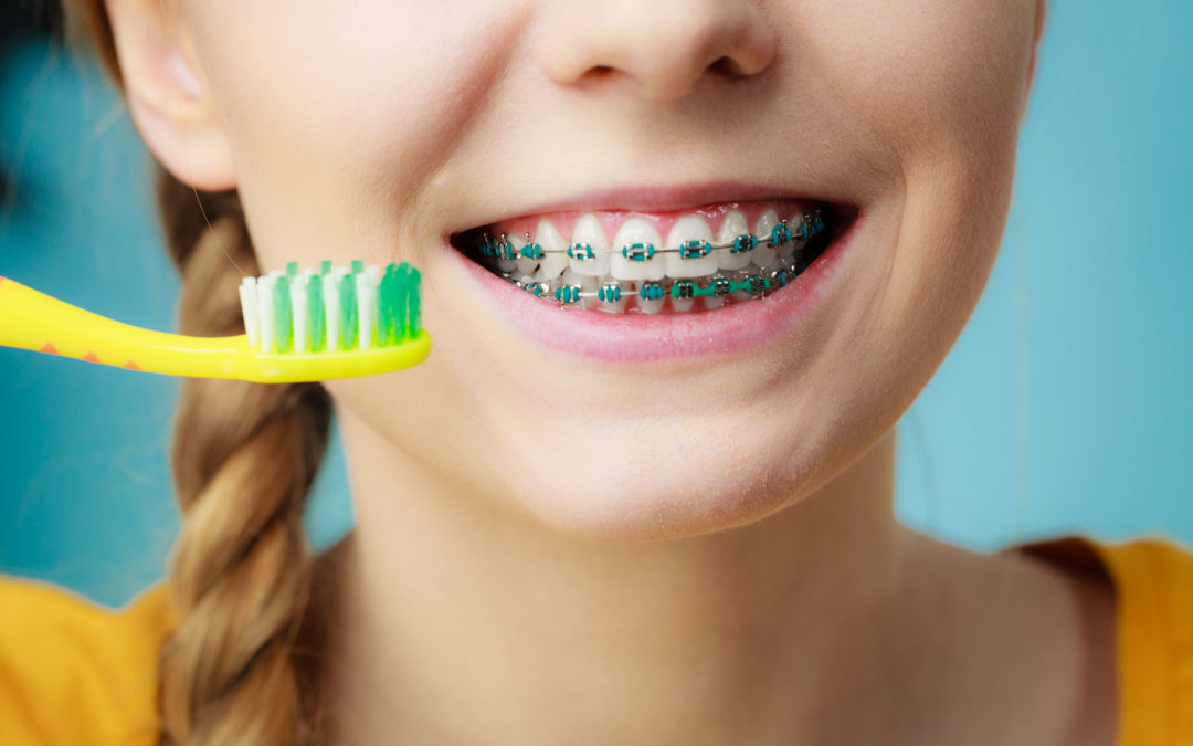 how much do children's braces cost