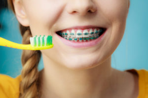 how much do children's braces cost