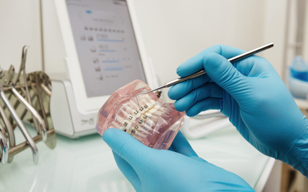 Orthodontic Care in Fort Pierce, FL: What Are My Options?